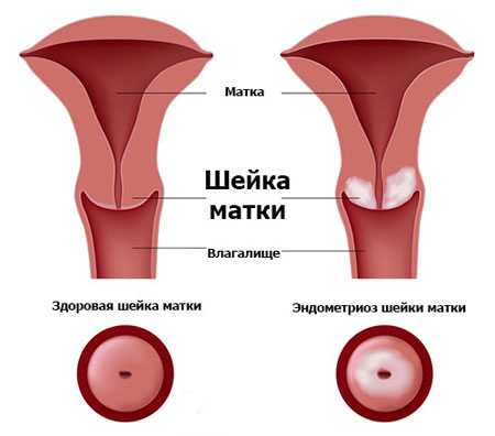 Сначала необходимо срезать ногти, тщательно вымыть, продезинфицировать руки, затем надеть медицинские перчатки
