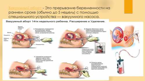 Вовторых, может быть очень сильное кровотечение