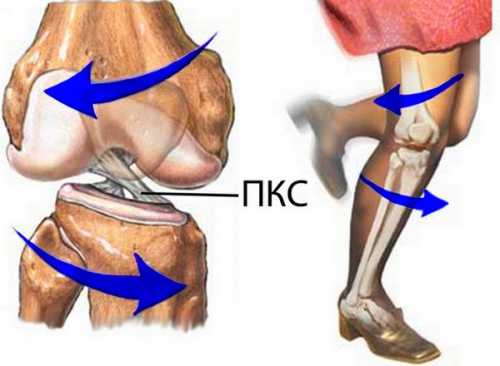 Как укрепить связки колена