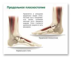 Отсутствие своевременного лечения приводит к серьезным осложнениям