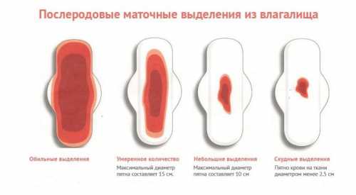 Гормональные причины связаны с дисфункцией яичников, когда избыточная концентрация эстрогенов провоцирует слишком сильное разрастание эндометрия