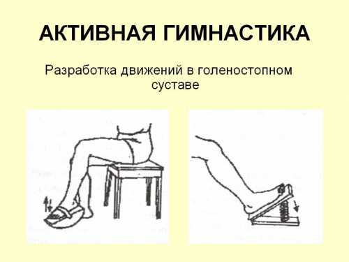 Разработка сустава после перелома