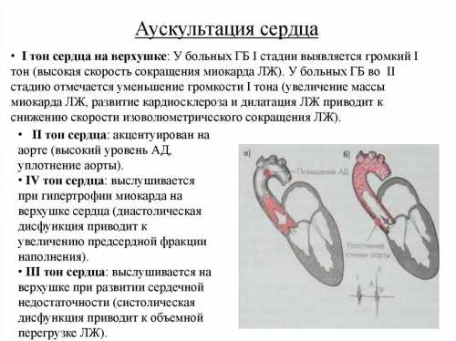 Это особые зоны проведения шумов, они являются точной проекцией клапанов сердца на грудной клетке