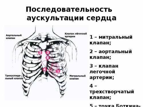 Аускультация сердца