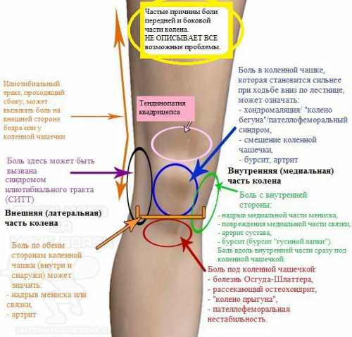 Если хрустит колено при приседании, это, в первую очередь, может свидетельствовать о наличии болезни опорно двигательного аппарата